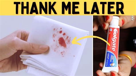 Remove Old Dried Blood Stains From Clothes White Shirt With Simple