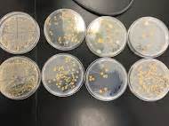Identifying Bacteria On Agar Plates