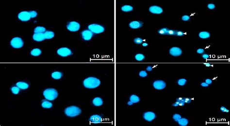 A Dead Cells Count Via Trypan Blue Dye Exclusion Method Expressed