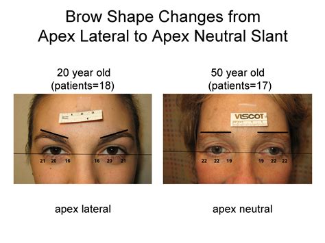 Aaps Aaps 2009 Annual Meeting Abstracts Changes In Eyebrow Position