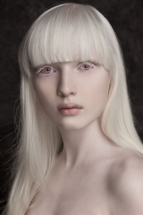 Personal Sanz Lénaïc Photographe Albino Girl Albino Model Portrait