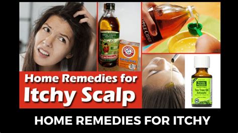 Home Remedy For Itchy Scalp Home Remedies For Itchy Scalp Youtube