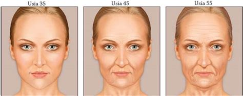 1. Proses Penuaan Pada Wajah