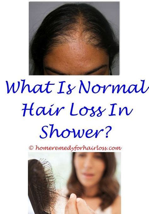 Hair Loss In Shower Normal Try Your Best Day By Day Account Image Archive