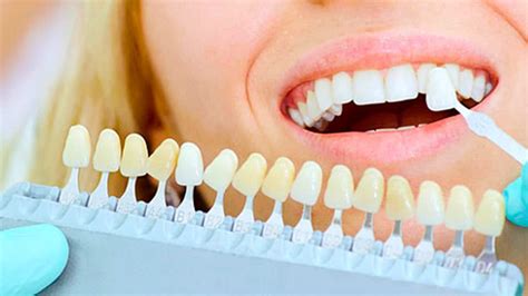 Dental Implants | Dent Care Dental Clinic