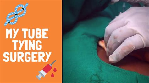 My Tube Tying Surgery Tubal Ligation Procedure Youtube