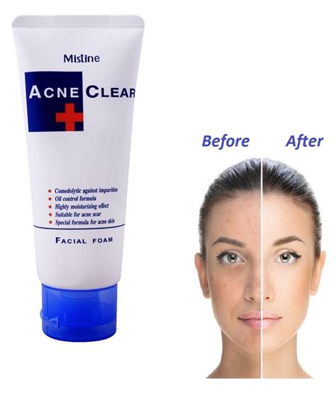 Mistine Acne Clear Facial Foam Multipurpose Gentle Skin Care Face Wash