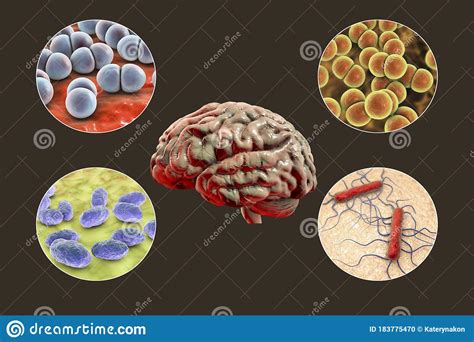 Etiology Of Bacterial Meningitis Stock Illustration Illustration Of