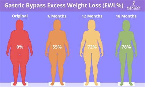 How Much Weight Will I Lose With Gastric Bypass Surgery Infographic