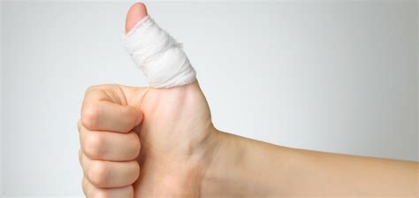 broken finger everything you need to know and what you should do