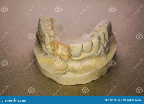 Denture Impression Made Of Plaster With Implants Stock Image Image Of
