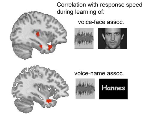 How Humans Recognize Voices Ask A Biologist