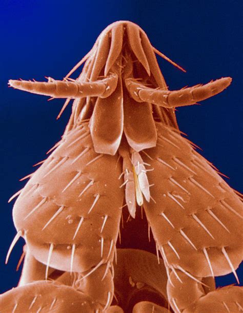 Scanning Electron Micrograph Of Cat Fleas Head Photograph By K H