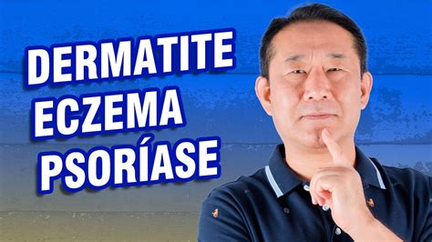 Dermatite Atópica Eczéma E Psoriase Peter Liu YouTube