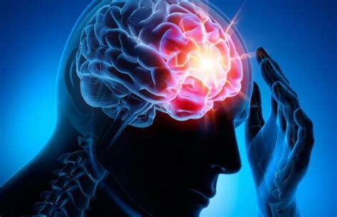 Accidente cerebrovascular significado signos síntomas causas