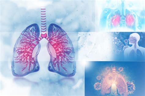 UF Health’s Rare Lung Disease Program Explores Diagnosis and Treatment