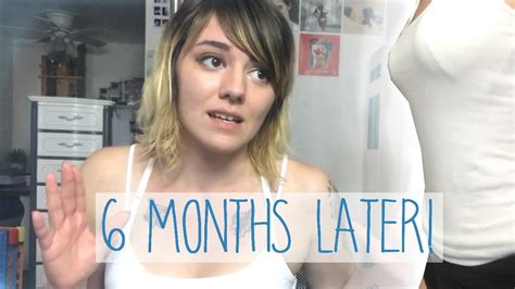 Breast Reduction Post Op 6 Months Later No Sensitivity Youtube