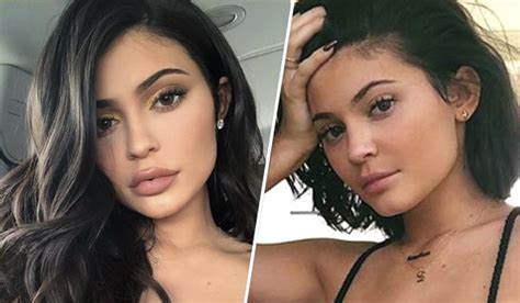 kylie jenner has removed her lip fillers and she looks like her old self again