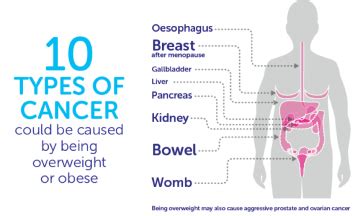 Cruk Obesity And Cancer Risk Top Pancreatic Cancer Awareness Pancreatic Cancer Action
