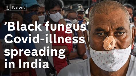Covid Linked ‘black Fungus Infection Spreading In India Youtube