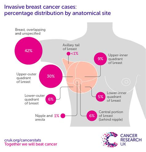 Breast Cancer Incidence Invasive Statistics Cancer Research Uk