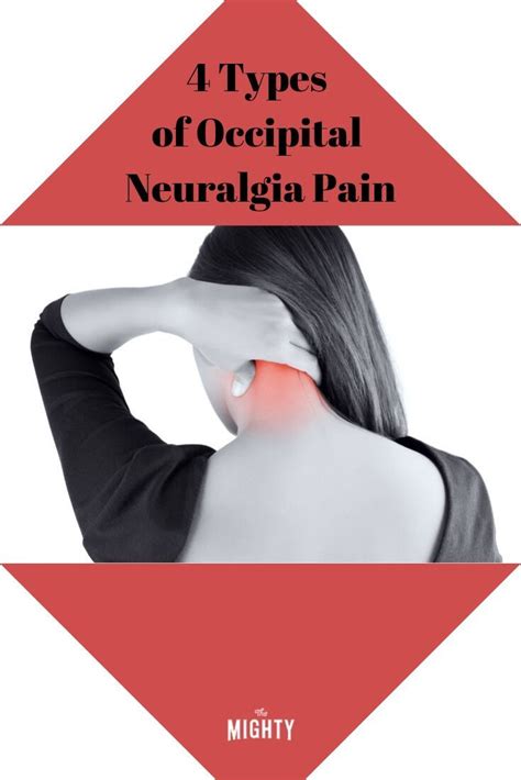 4 Ways People With Occipital Neuralgia Describe Their Pain Artofit