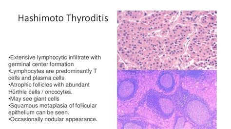 Practical 3 Thyroid Pathology 2019