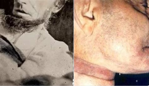 Death Photo Of Robin Williams And The Death Photo Of Abraham Lincoln