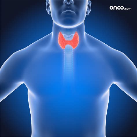 Stage 1 Throat Cancer Early Localized Throat Cancer All About