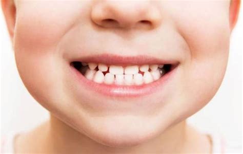 دندان قروچه از علل تا عوارض مجله آموزشی جامعه دندانپزشکی