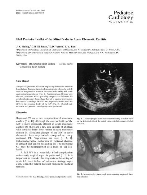 Pdf Flail Posterior Leaflet Of The Mitral Valve In Acute Rheumatic