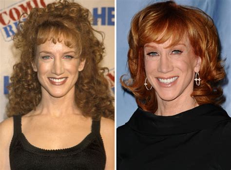 Ruby wax interviews kathy griffin (then of the show suddenly susan) for her 1999 lifetime series in the us. Kathy Griffin Plastic Surgery ~ In CelebrityIn celerity