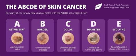 A General Guide To Melanoma And Skin Cancer In Singapore By Medical Oncologist Dr Donald Poon