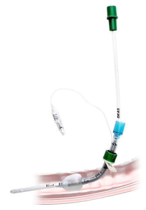 Safety tube prevents collapsing or kinking. Tracheostomy Cannula Exchange Guide - DEAS