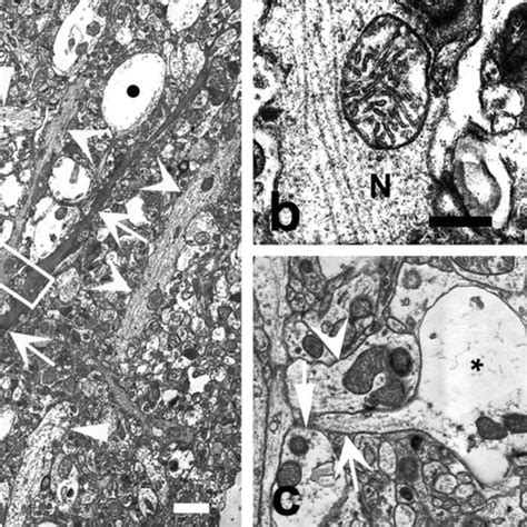 Appearance Under Electron Microscopy Of Normal Looking A And B