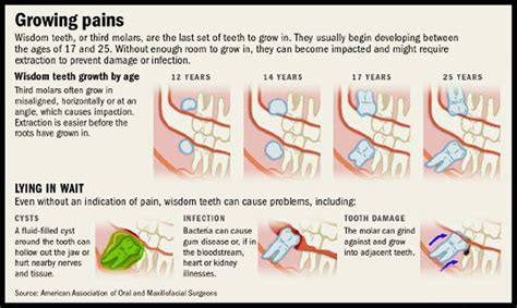 How To Lessen Wisdom Tooth Pain Leahleedesigns