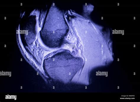 Simple Science: How to Make a Volcano with Kids