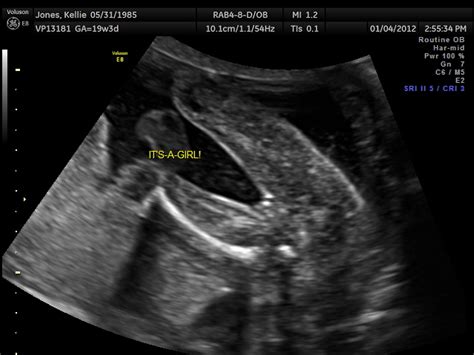 Keeping Up With The Joneses 20 Week Ultrasound