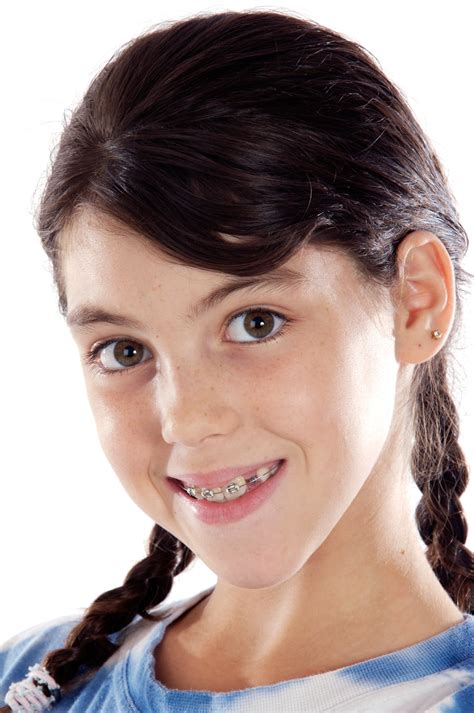 Adorable Girl With Braces Dr George Dds