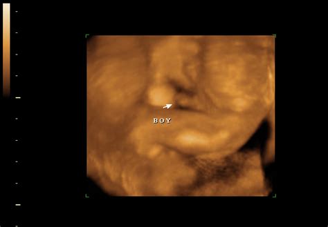 How Will Your Baby Look In A 3d Ultrasound