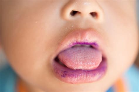 A Comprehensive Guide To Common Mouth Diseases And Their Treatments
