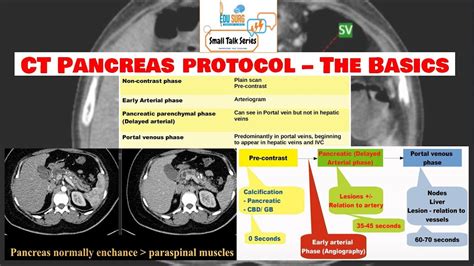 Ct Scan Of The Pancreas Pancreas Protocol Ct Scan Imaging Of The