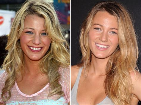 Blake Lively Before And After Celebrity Beauty Secrets Celebrity Beauty Blake Lively