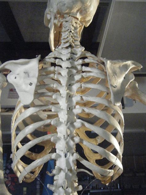 Skeleton Human Back Bones Bone Bruise Causes Symptoms Diagnosis