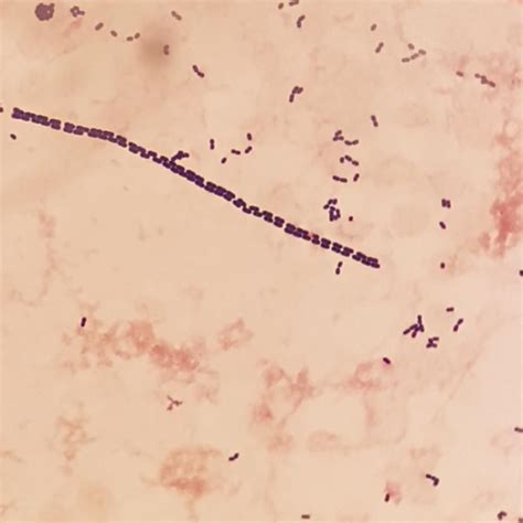 Microscopy Gram Stain Of Streptococcus Mitis Shaped Like A Zipper