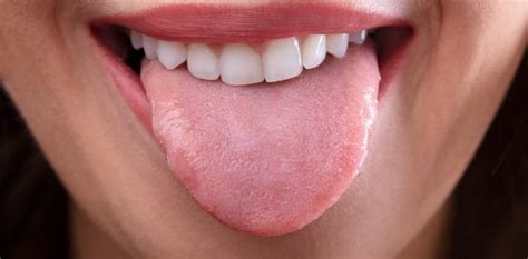 Why Does My Tongue Feel Funny Tindale Dental Penrith Dentist