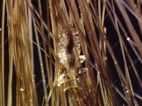 Head Louse On Human Hair Stock Video Clip K0050951 Science Photo