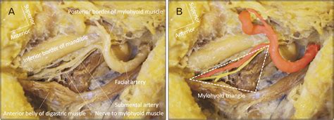 Mylohyoid Muscle Cadaver