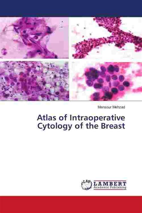 Pdf Atlas Of Intraoperative Cytology Of The Breast By Mansour Mehzad