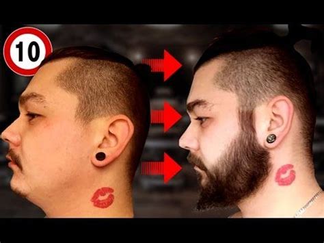 After one year of treatment, the average number of hairs in the observed area increased by 112 hairs. Top 10 Most Impressive Minoxidil Beards - YouTube | Barbe